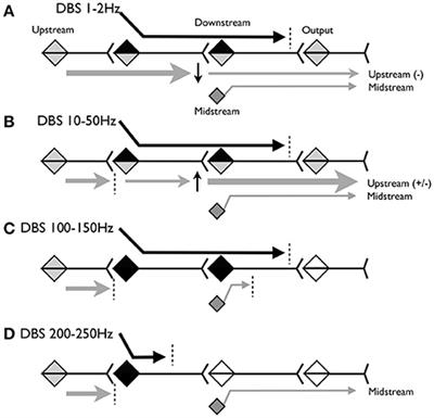 A Computational Model of Deep-Brain Stimulation for Acquired Dystonia in Children